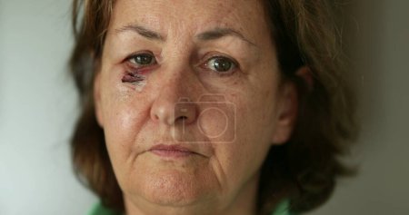 Foto de Mujer mayor con la cara golpeada y con la cicatriz sacudiendo la cabeza con desaprobación - Imagen libre de derechos