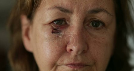 Foto de Primer plano de la mujer mayor con moretones, cara cicatrizada mirando a la cámara - Imagen libre de derechos
