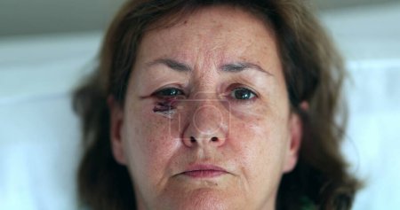 Téléchargez les photos : Femme plus âgée avec cicatrice ecchymose visage ouvrant les yeux regardant à la caméra - en image libre de droit