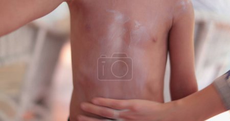 Téléchargez les photos : Mère écartant la lotion solaire pour enfant garçon - en image libre de droit
