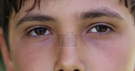 Photo for Young boy opening eyes looking to camera. Child eye staring to viewer - Royalty Free Image