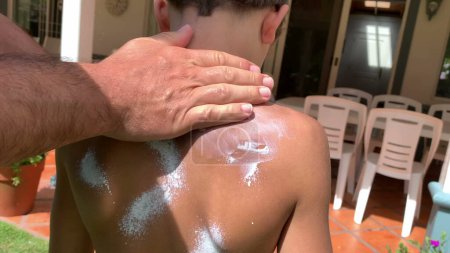 Photo for Father applying sunscreen lotion to child boy back. Parent rubbing sunblock to kid - Royalty Free Image