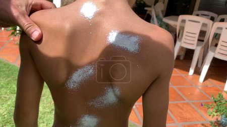 Téléchargez les photos : Parent pulvérisation crème solaire lotion à l'enfant retour - en image libre de droit