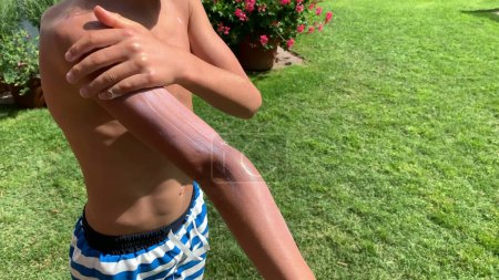 Photo for Child boy spreading and applying sunscreen lotion on body - Royalty Free Image