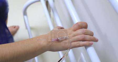 Photo for Hand connected to IV drip at hospital holding on bar - Royalty Free Image