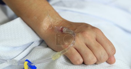 Téléchargez les photos : Close-up of hand connected to IV drip at hospital - en image libre de droit