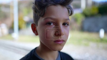 Photo for Serious young boy close-up face looking at camera standing outside - Royalty Free Image
