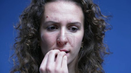 Foto de Mujer nerviosa mordiéndose las uñas sintiéndose vacilante, cara de cerca de la persona femenina en los años 20 sintiendo estrés y preocupación. emoción ansiosa - Imagen libre de derechos