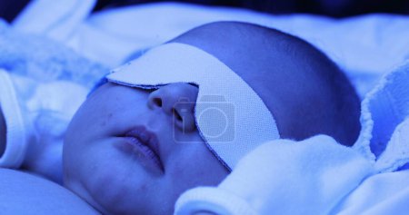 Foto de Newborn baby boy under phototherapy lamp. getting treated for jaundice - Imagen libre de derechos