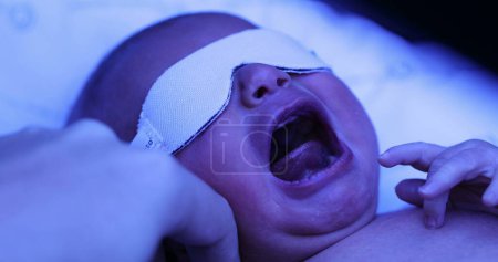 Foto de Newborn baby boy getting treated for jaundice under a phototherapy lamp - Imagen libre de derechos