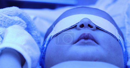Foto de Newborn baby boy under phototherapy lamp. getting treated for jaundice - Imagen libre de derechos