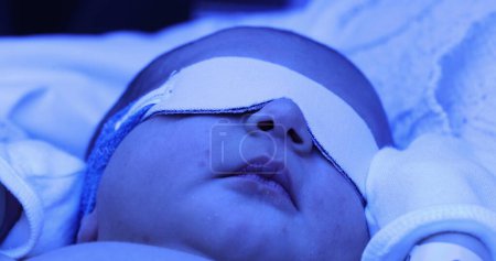 Photo for Newborn baby boy under phototherapy lamp. getting treated for jaundice - Royalty Free Image