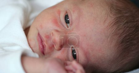 Foto de Newborn baby face with tired look - Imagen libre de derechos