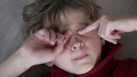 Téléchargez les photos : Fatigué jeune garçon frottant les yeux avec les mains, gros plan sur le visage d'un enfant fatigué touchant le visage avec des démangeaisons oculaires - en image libre de droit