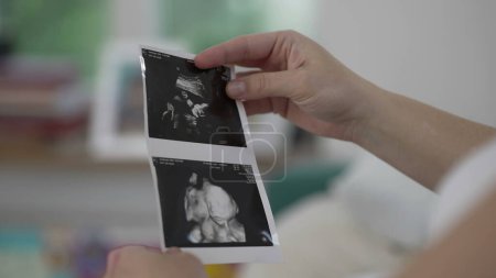 Großaufnahme der Hand der Mutter mit Ultraschallbild des ungeborenen Babys - mütterliche Vorfreude