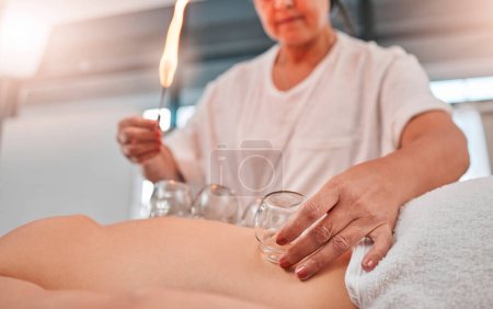 Relax, cupping massage and man at a spa for wellness, healing and holistic therapy with woman therapist. Hand cup therapy and fire treatment on client at resort for toxins, blood and circulation.