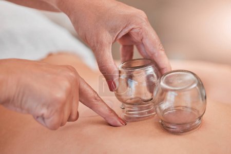 Photo for Cupping, therapy and back massage at a wellness, health and beauty spa at a self care resort. Healing, body care and hands of a therapist doing healthy treatment with vacuum glasses for stress relief. - Royalty Free Image