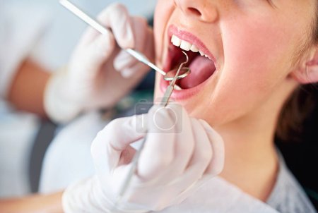 Photo for Looks like weve found a cavity. Closeup shot of a young girl having a checkup at the dentist - Royalty Free Image