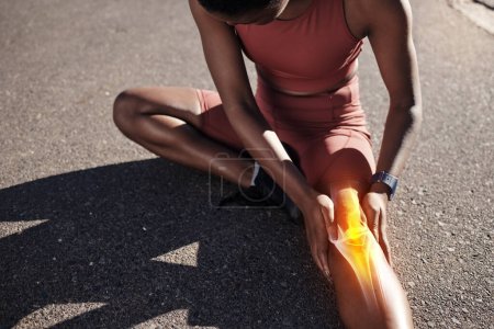 Téléchargez les photos : Rayons X, blessures aux jambes et entraînement de la femme noire avec douleur médicale, tension corporelle et urgence lors d'un marathon sportif. Douloureux, muscle cassé et coureur africain avec un accident du genou pendant une séance d'entraînement. - en image libre de droit