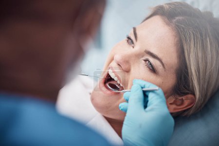 Zähne, Zähne oder Frauen beim Zahnarzt für Chirurgie, Zahnaufhellung oder Mundreinigung gegen Zahnfleischbakterien. Wellness, Karies oder Hände, die in der Klinik helfen oder mit oralen Werkzeugen arbeiten.