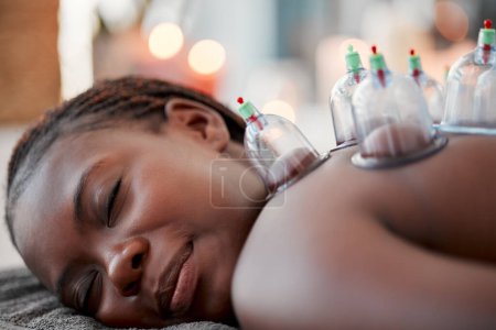 Téléchargez les photos : Black woman, face and smile in cupping therapy on back for pain relief, relaxation or blood flow at resort. Happy African American female smiling in relax for glass vacuum cups in deep tissue massage. - en image libre de droit