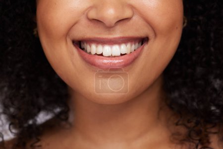 Photo for Black woman, teeth and smile for dental care, whitening or oral and mouth treatment. Closeup of happy African American female model smiling for dentist results, healthcare or clean tooth hygiene. - Royalty Free Image