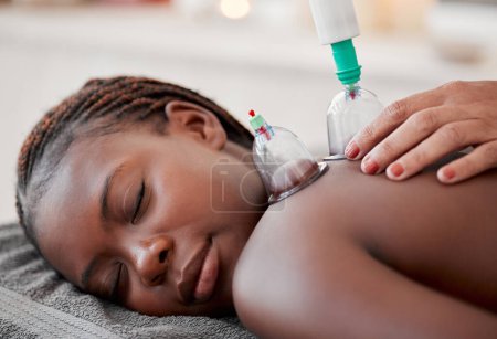 Téléchargez les photos : Black woman, hands and cupping therapy on back in spa for pain relief, blood flow and relaxation at resort. Hand of therapist with glass vacuum cups on African American female in deep tissue massage. - en image libre de droit
