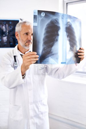 Photo for He knows exactly what to look for. a mature male doctor examining an x-ray image - Royalty Free Image