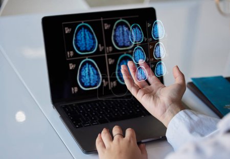 Téléchargez les photos : Brain x ray graphique, résultats cliniques et les mains du médecin avec rapport numérique sur le travail de neurologie. Données d'anatomie, de radiographie et d'évaluation avec un employé de la santé détenant des informations de test IRM dans un hôpital. - en image libre de droit