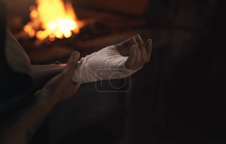 Photo for How safe is your work space. a woman working at a foundry with a bandage wrapped around her hand - Royalty Free Image