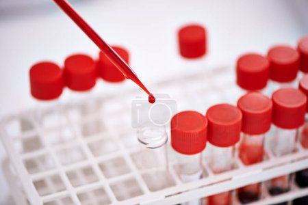 Photo for Your blood tells a story. Closeup shot of a scientist working with blood samples in the lab - Royalty Free Image