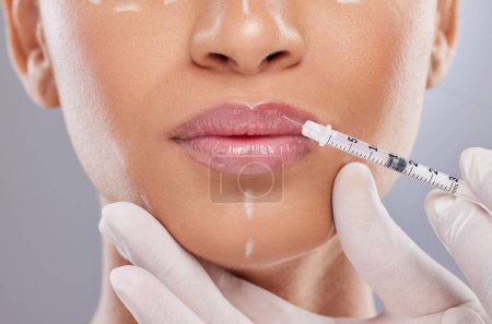Photo for Keeping up with trends. an unrecognisable woman getting lip filler injections in the studio - Royalty Free Image