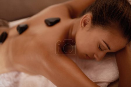 Photo for Back, hot stone massage and woman in bed with luxury service for muscle, body and relax with peace in resort. Girl, hospitality and physical therapy for spine with wellness, spa and natural healing. - Royalty Free Image