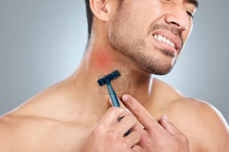 Disposable razors are not the best option. a man getting razor burn from shaving with a disposable razor