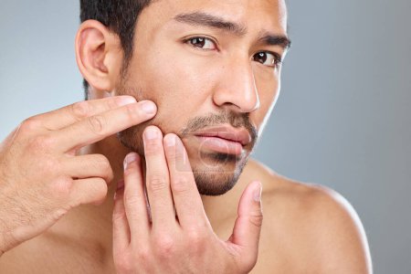 Photo for Is that a pimple I see. a man inspecting his skin while standing against a grey background - Royalty Free Image