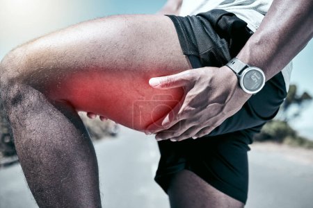 Photo for Fitness, thigh and injury with a sports man holding his muscle in pain while outdoor for a workout. Exercise, anatomy and accident with a male athlete feeling strain while training for recreation. - Royalty Free Image