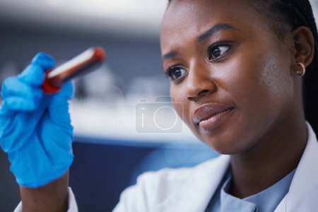 Photo for Science, blood vial and female scientist in a lab working on a medical experiment, test or exam. Biotechnology, pharmaceutical and African woman researcher doing scientific research in a laboratory - Royalty Free Image