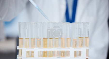 Photo for Pipette, test tube and scientist with liquid for research, experiment and sample. Science, medical professional and doctor with dropper for chemistry, medicine and healthcare study in laboratory - Royalty Free Image