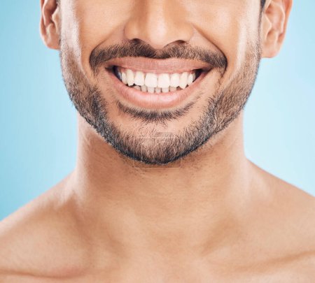 Foto de Sonrisa, blanqueamiento de dientes y la boca de un hombre en un fondo de estudio para un tratamiento de dentista. Resultados de salud, bienestar y dientes de una persona o modelo con cirugía dental u oral en un contexto de belleza. - Imagen libre de derechos