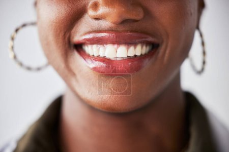 Téléchargez les photos : Sourire, heureux et bouche gros plan de femme noire avec blanchiment des dents, soins dentaires et bien-être. Soins de santé, dentisterie et zoom du visage de la femme avec nettoyage pour l'hygiène, le toilettage et le traitement. - en image libre de droit