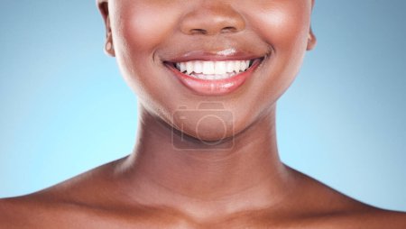 Photo for Woman, teeth and smile in dental care, hygiene or treatment against a blue studio background. Closeup of female person mouth in tooth whitening, oral or gum healthcare or cleaning in healthy wellness. - Royalty Free Image