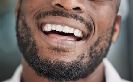 Téléchargez les photos : Dents, bouche et heureux homme noir ou homme d'affaires avec un sourire dentaire dans la société de démarrage après le traitement dans un bureau. Propre, africain et le visage d'un homme d'affaires ou d'un employé avec dentiste santé buccodentaire. - en image libre de droit