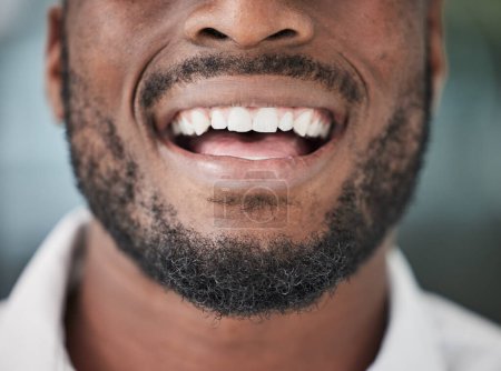 Foto de Primer plano dental, sonrisa y boca del hombre para los resultados de tratamiento cosmético, de cuidado e higiene bucal. Feliz, blanqueamiento de dientes y persona masculina confiada, respiración o limpieza de dientes, blanqueamiento o satisfacción. - Imagen libre de derechos