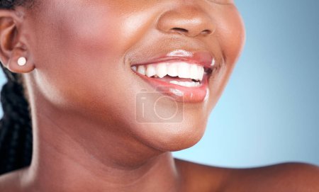 Téléchargez les photos : Femme, dents et sourire dans le nettoyage dentaire, l'hygiène ou le traitement sur fond de studio bleu. Gros plan de la bouche de la personne féminine dans le blanchiment des dents, soins buccodentaires ou des gencives pour un bien-être sain. - en image libre de droit