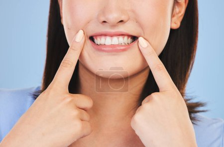 Téléchargez les photos : Femme, sourire propre et point en gros plan studio pour les soins dentaires, blanchiment des dents ou heureux par fond bleu. Fille, bouche et excité pour la beauté, la transformation et le bien-être dentaire pour l'hygiène. - en image libre de droit