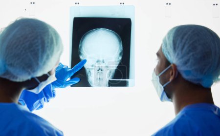 Photo for Head xray, doctors and healthcare team planning test results, charts and advice for medical analysis. Radiology, neurology and surgeons check skull x ray, anatomy and review mri for hospital surgery. - Royalty Free Image
