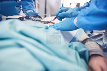 Photo for Surgery, group hands and patient operation, hospital emergency service or doctors teamwork on wound healing. Accident operating room, medical tools and closeup surgeon collaboration on saving client. - Royalty Free Image