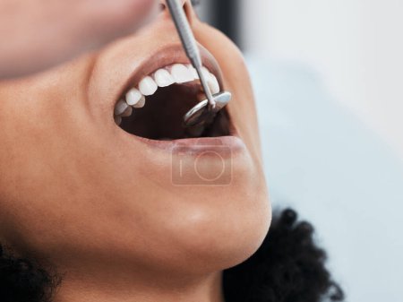 Foto de Boca, dientes de mujer y dentista con herramientas para cosméticos dentales, evaluación de la salud y prueba en la clínica. Servicio oral, ortodoncia y primer plano de paciente, espejo y excavadora para limpieza dental. - Imagen libre de derechos