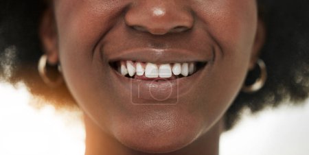 Photo for Dental, smile and teeth with closeup of person for medical, cosmetics and oral hygiene. Healthcare, orthodontics and beauty with mouth of black woman for self care, gum and whitening treatment. - Royalty Free Image