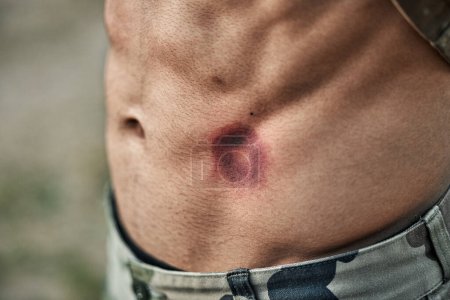 Photo for Paintball injury, stomach bruise and man in closeup with pain, shooting or accident for outdoor war games. Abdomen, emergency and wound in military training, zoom and battlefield for exercise in army. - Royalty Free Image